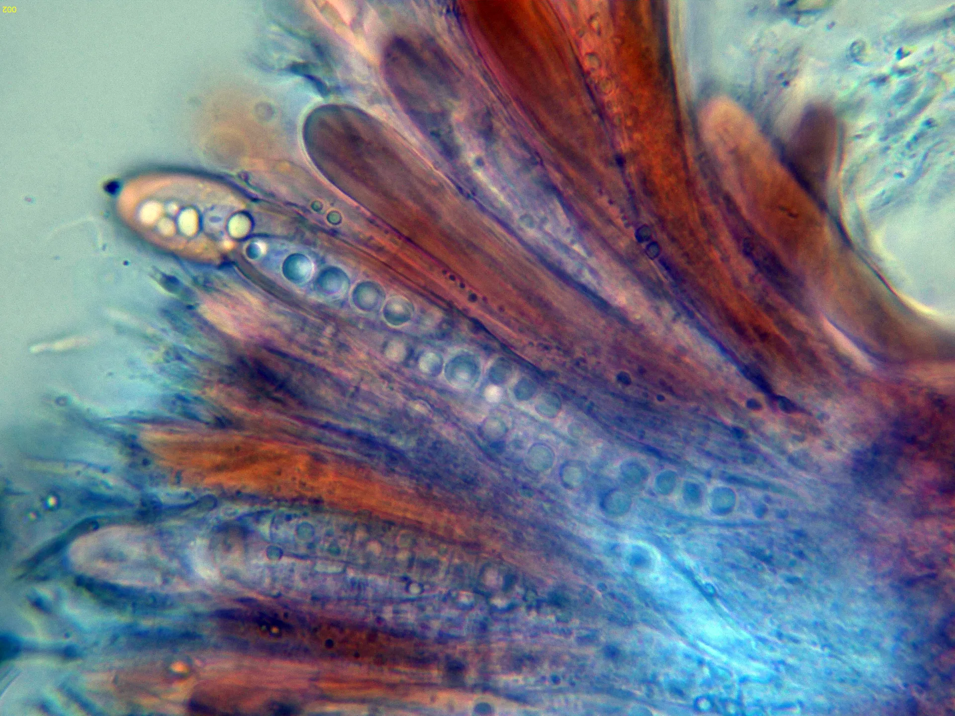 Microscopía de Patellaria atrata - 10 - Ascos-002